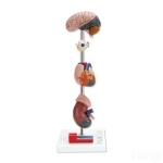 Human Hypertension Model, 6 Parts