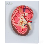 Human Kidney Model